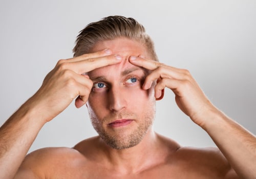 La guida definitiva ai prodotti per il viso da uomo per pelli a tendenza acneica